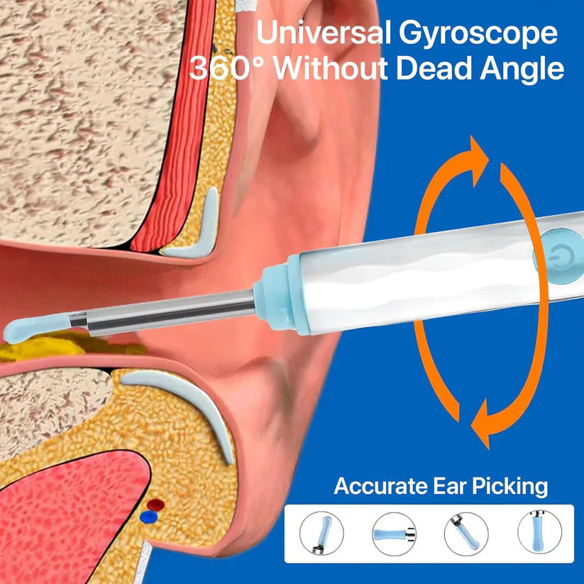 Smart Visual Ear Wax Cleaner With Camera