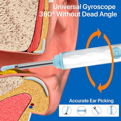 Smart Visual Ear Wax Cleaner With Camera