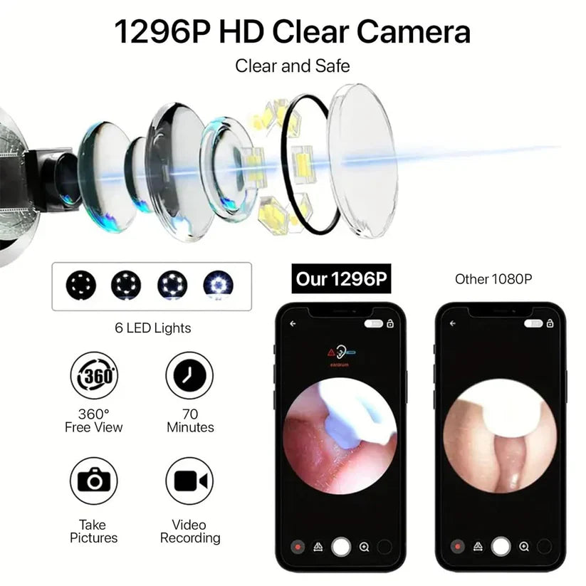 Smart Visual Ear Wax Cleaner With Camera